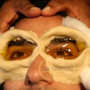 dr-gupta-ayurveda-7-Netratarpana